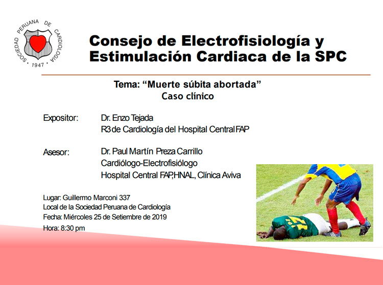 Consejo de Electrofisiología y estimulación Cardiaca de la Sopecard