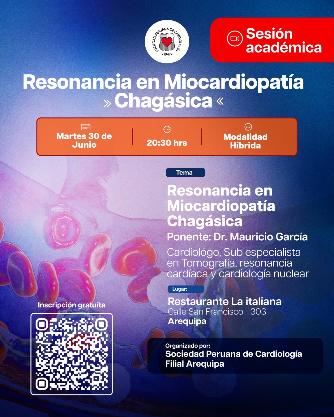 Resonancia en Miocardiopatía – Chagásica